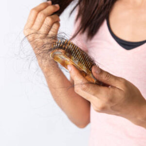 Γυναικεία Τριχόπτωση