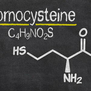 Ομοκυστεΐνη