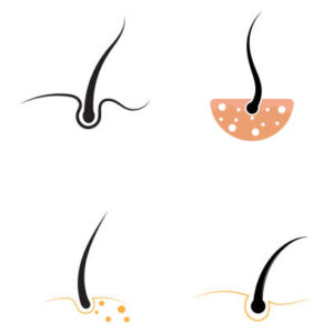 Μαλλιά / Γένια